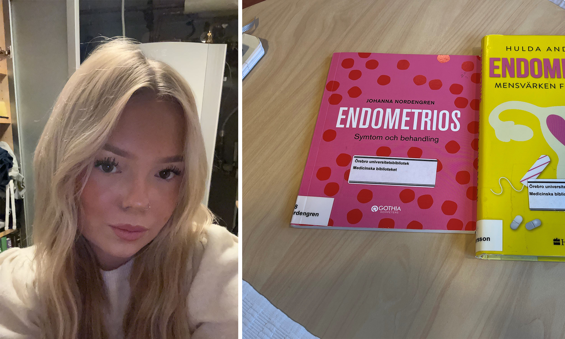 Endometrios