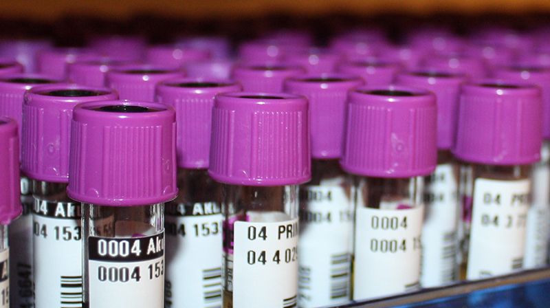 Labbrör, foto Elin Abelson