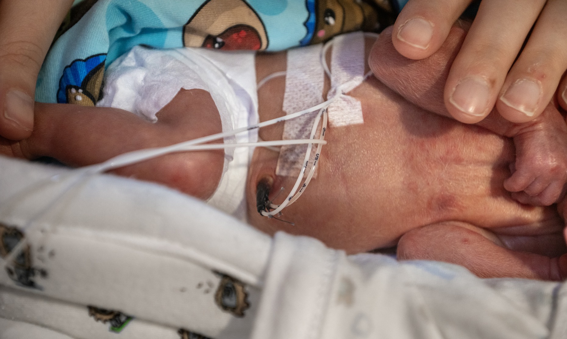 Närbild på en infart i naveln.